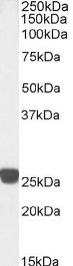 Cardiac Troponin I Chimeric Antibody in Western Blot (WB)