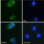 EGFR Chimeric Antibody in Immunocytochemistry (ICC/IF)