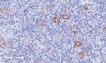 CD30 Chimeric Antibody in Immunohistochemistry (Paraffin) (IHC (P))