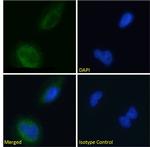 BACE2 Chimeric Antibody in Immunocytochemistry (ICC/IF)