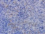 Efalizumab Antibody in Immunohistochemistry (Paraffin) (IHC (P))