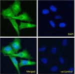 EDB-FN Chimeric Antibody in Immunocytochemistry (ICC/IF)