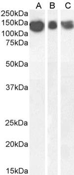 beta Amyloid Chimeric Antibody in Western Blot (WB)