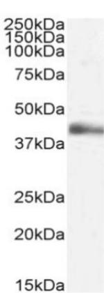 TNF beta Chimeric Antibody in Western Blot (WB)