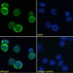 MHC Class I Chimeric Antibody in Immunocytochemistry (ICC/IF)