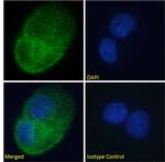 DARC Chimeric Antibody in Immunocytochemistry (ICC/IF)