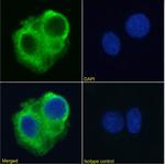 TRAIL-R2 (DR5) Chimeric Antibody in Immunocytochemistry (ICC/IF)