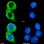 CMKLR1 Chimeric Antibody in Immunocytochemistry (ICC/IF)