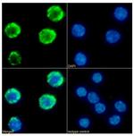 IFNGR1 (CD119) Chimeric Antibody in Immunocytochemistry (ICC/IF)