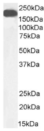 CD66 Antibody in Western Blot (WB)