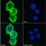 CD155 Chimeric Antibody in Immunocytochemistry (ICC/IF)