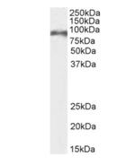 CD155 Chimeric Antibody in Western Blot (WB)