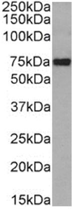 CD36 Chimeric Antibody in Western Blot (WB)