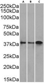 CD37 Chimeric Antibody in Western Blot (WB)