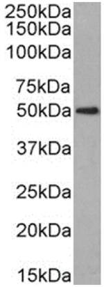 CD63 Chimeric Antibody in Western Blot (WB)