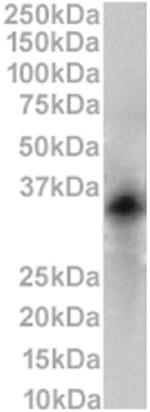 CD79b Chimeric Antibody in Western Blot (WB)