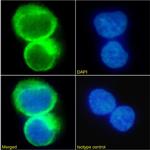 CCR5 Chimeric Antibody in Immunocytochemistry (ICC/IF)