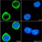 CCR5 Chimeric Antibody in Immunocytochemistry (ICC/IF)