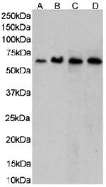 CCR5 Chimeric Antibody in Western Blot (WB)