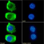 CCR9 Chimeric Antibody in Immunocytochemistry (ICC/IF)