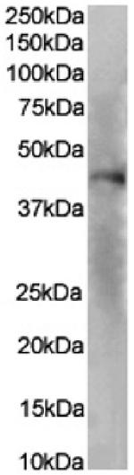 CXCR1 Chimeric Antibody in Western Blot (WB)