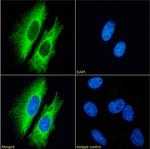 Cytokeratin 7 Chimeric Antibody in Immunocytochemistry (ICC/IF)