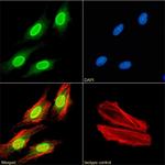 H3K27me3 Chimeric Antibody in Immunocytochemistry (ICC/IF)