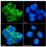 EpCAM (CD326) Chimeric Antibody in Immunocytochemistry (ICC/IF)