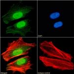 HP1 beta Chimeric Antibody in Immunocytochemistry (ICC/IF)