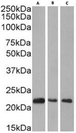 HP1 beta Chimeric Antibody in Western Blot (WB)