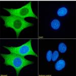 PRMT3 Chimeric Antibody in Immunocytochemistry (ICC/IF)