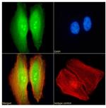 TDRD3 Chimeric Antibody in Immunocytochemistry (ICC/IF)