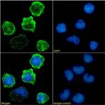 CD18 Chimeric Antibody in Immunocytochemistry (ICC/IF)