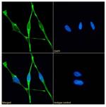 Mesothelin Chimeric Antibody in Immunocytochemistry (ICC/IF)