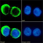 CD37 Chimeric Antibody in Immunocytochemistry (ICC/IF)