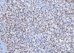 SP1 Antibody in Immunohistochemistry (Paraffin) (IHC (P))