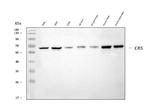 CBS Antibody in Western Blot (WB)