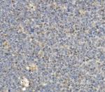 CCR2 Antibody in Immunohistochemistry (Paraffin) (IHC (P))