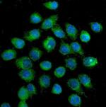 GLUT1 Antibody in Immunocytochemistry (ICC/IF)