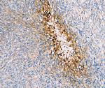 GLUT1 Antibody in Immunohistochemistry (Paraffin) (IHC (P))