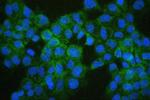 COMT Antibody in Immunocytochemistry (ICC/IF)