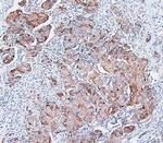 COMT Antibody in Immunohistochemistry (Paraffin) (IHC (P))