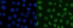 XRCC1 Antibody in Immunocytochemistry (ICC/IF)