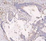 APOBEC3G Antibody in Immunohistochemistry (Paraffin) (IHC (P))