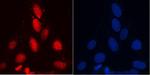 UPF1 Antibody in Immunocytochemistry (ICC/IF)