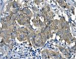 UPF1 Antibody in Immunohistochemistry (Paraffin) (IHC (P))