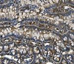 UPF1 Antibody in Immunohistochemistry (Paraffin) (IHC (P))