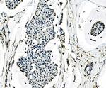 SF1 Antibody in Immunohistochemistry (Paraffin) (IHC (P))