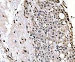 SF1 Antibody in Immunohistochemistry (Paraffin) (IHC (P))