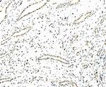 SF1 Antibody in Immunohistochemistry (Paraffin) (IHC (P))